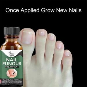 Nail Fungus (10 ML) (NW000189)